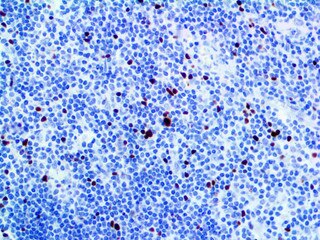 IHC of FOXP3 on an FFPE Tonsil Tissue